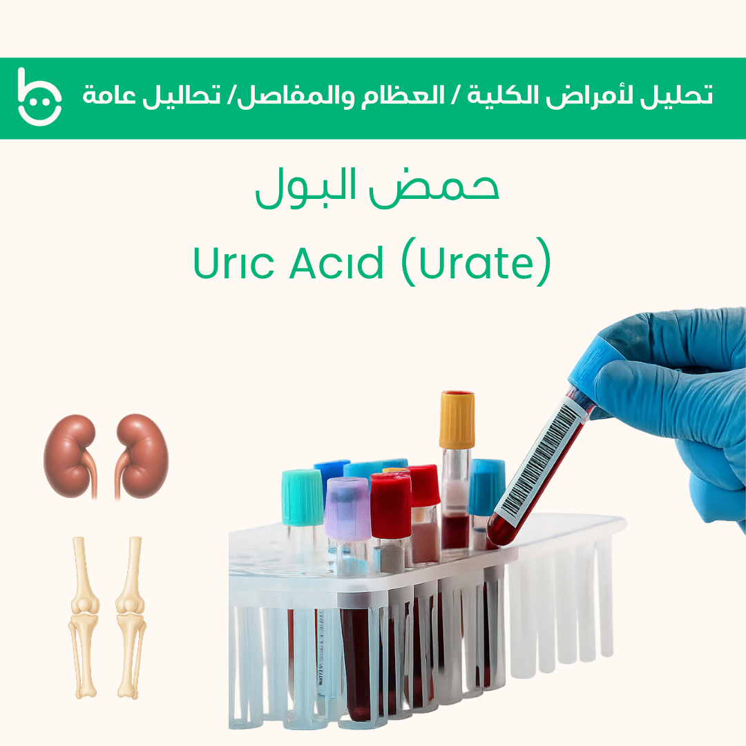 حمض البول / Urіc Acіd (Uratе)