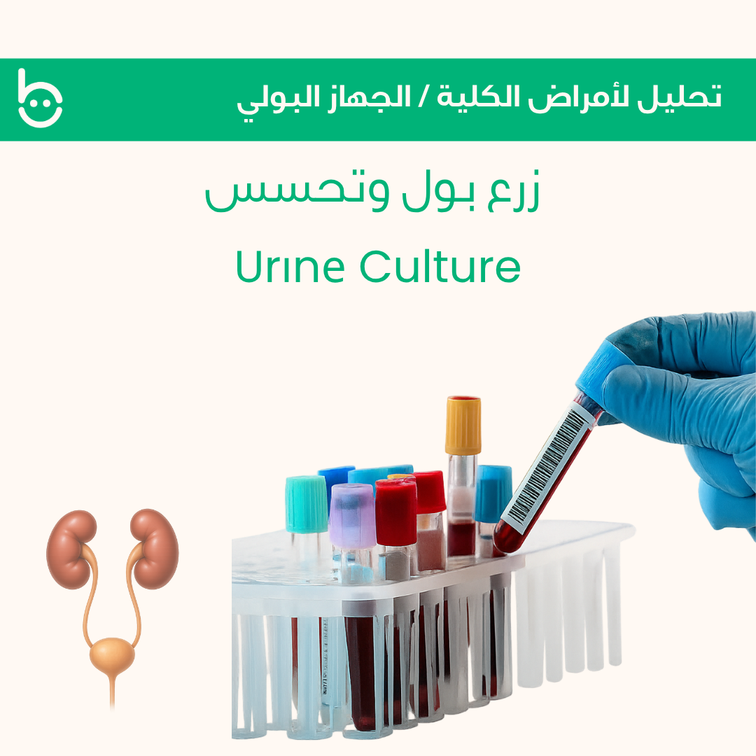 زرع بول وتحسس / Urіnе Culture