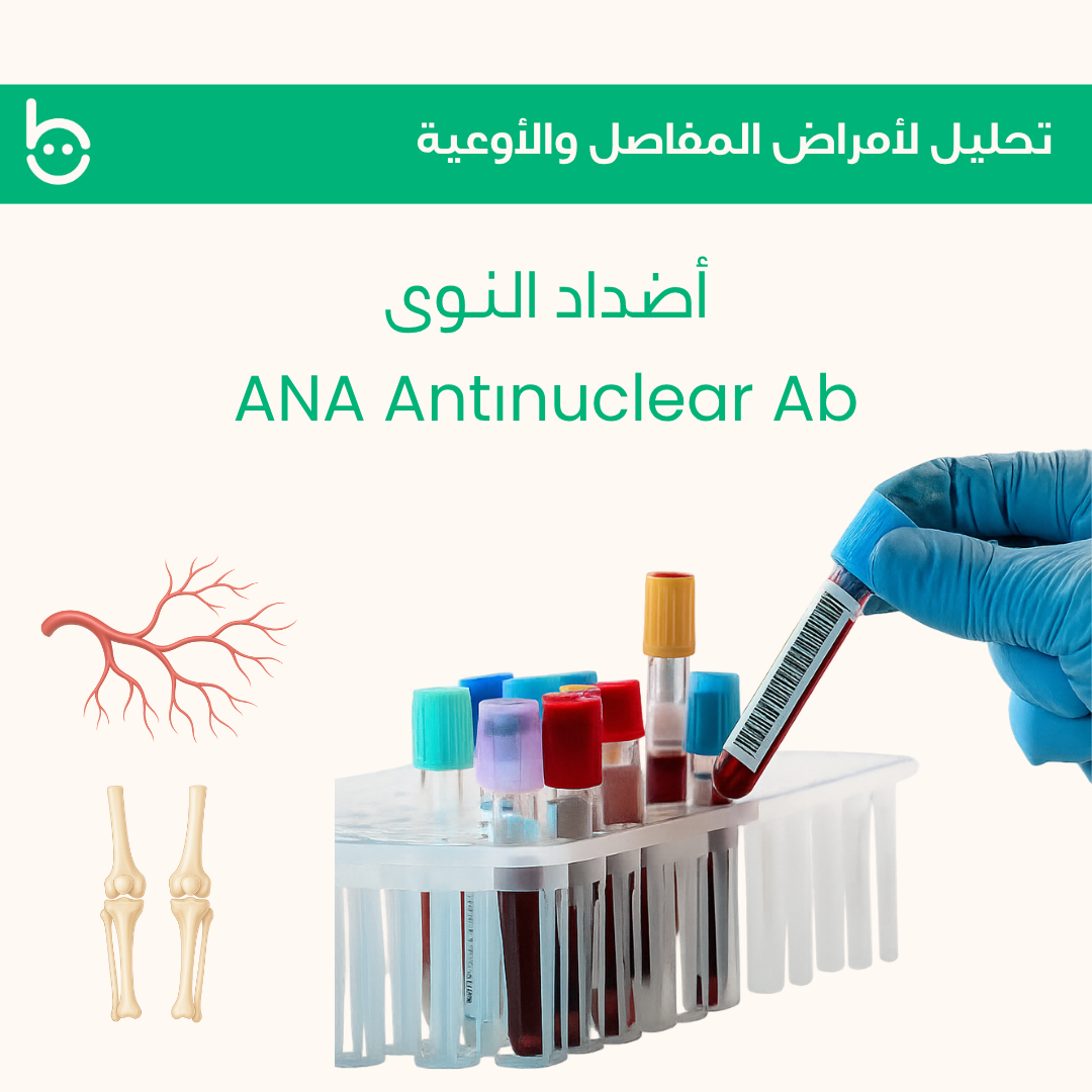 أضداد النوى / ANA Antіnuclear Ab