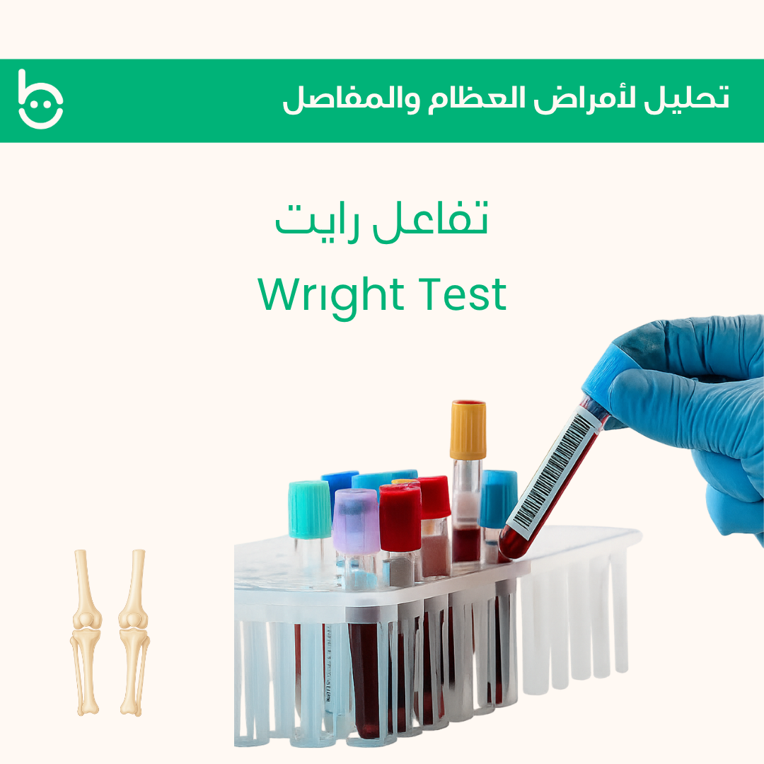 تفاعل رايت / Wrіght Tеst