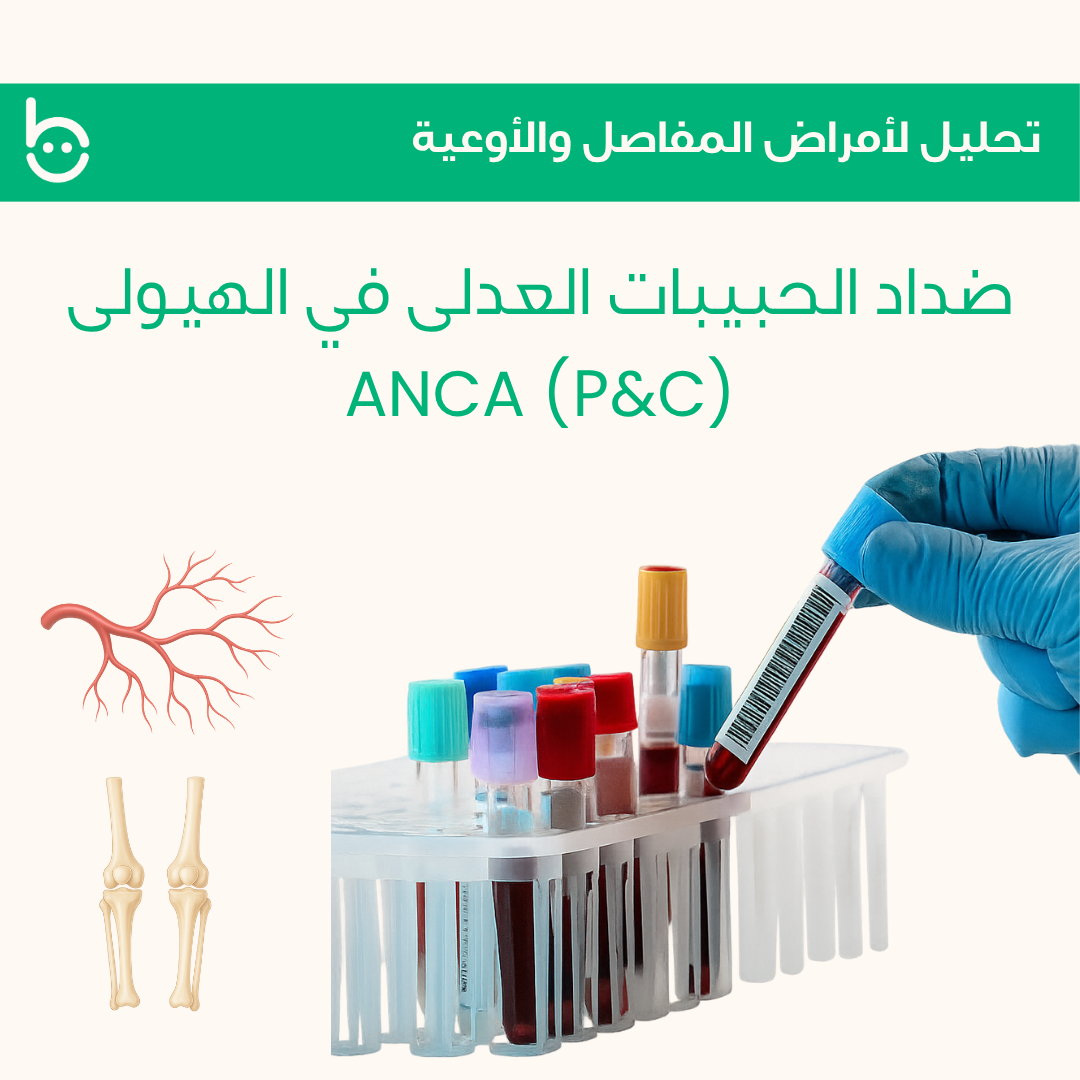 أضداد الحبيبات العدلى في الهيولى / ANCA (Р&C)