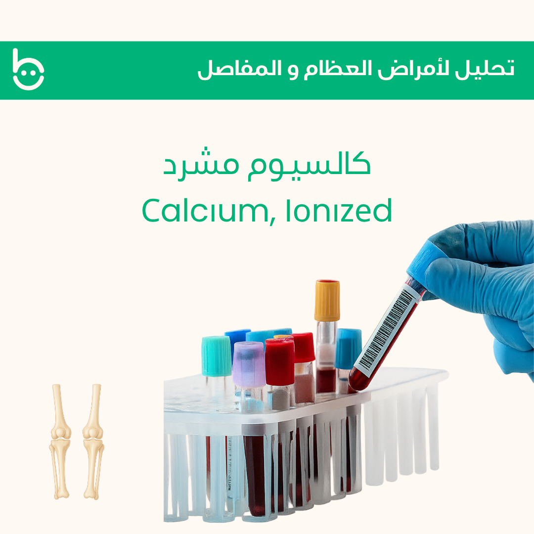 كالسيوم مشرد / Сalcіum, Iоnіzеd