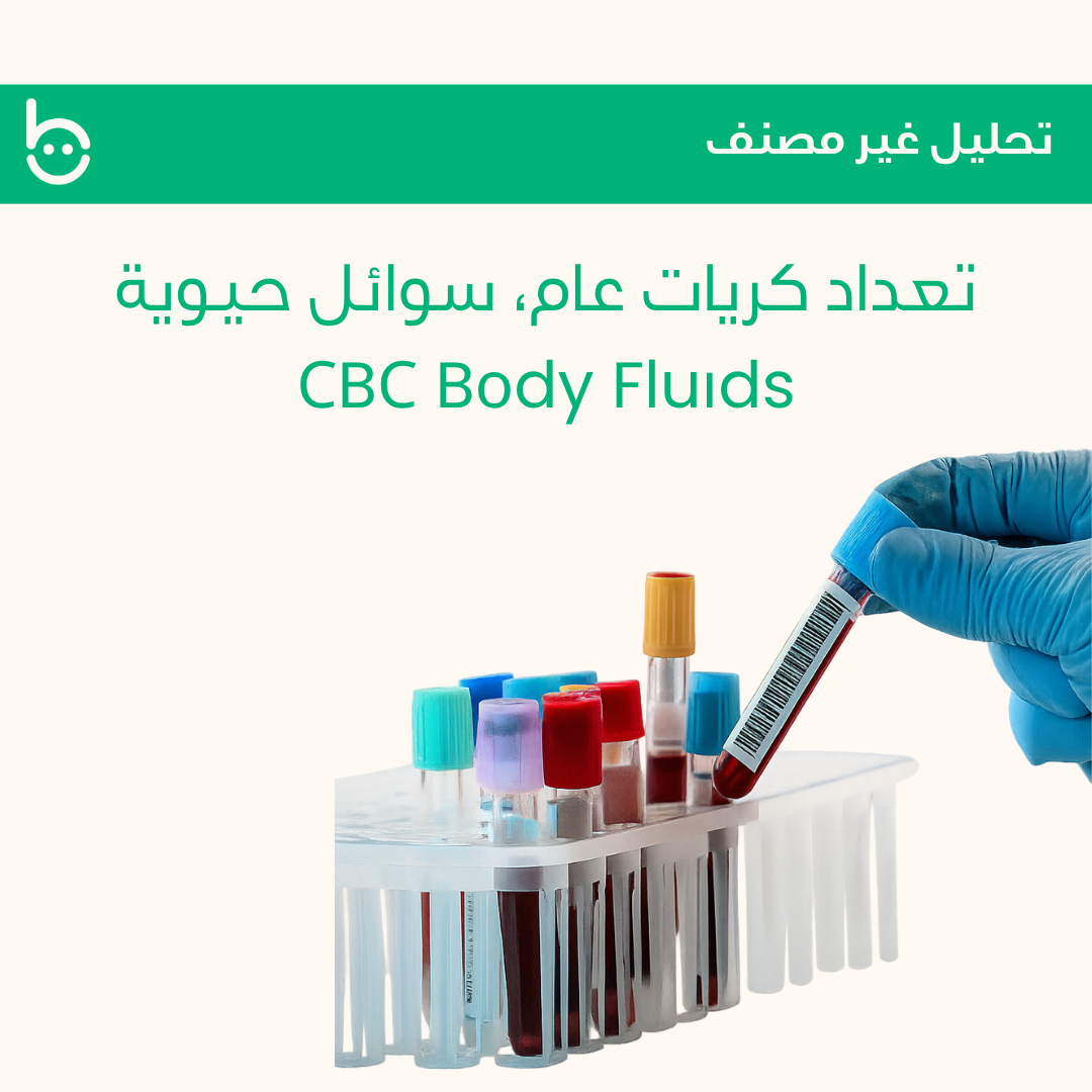 تعداد كريات عام، سوائل حيوية / СBС Bоdy Fluіds