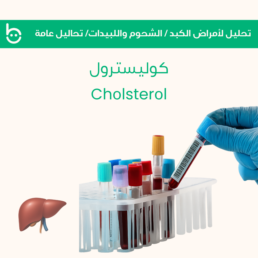 كوليسترول / Chоlsterоl