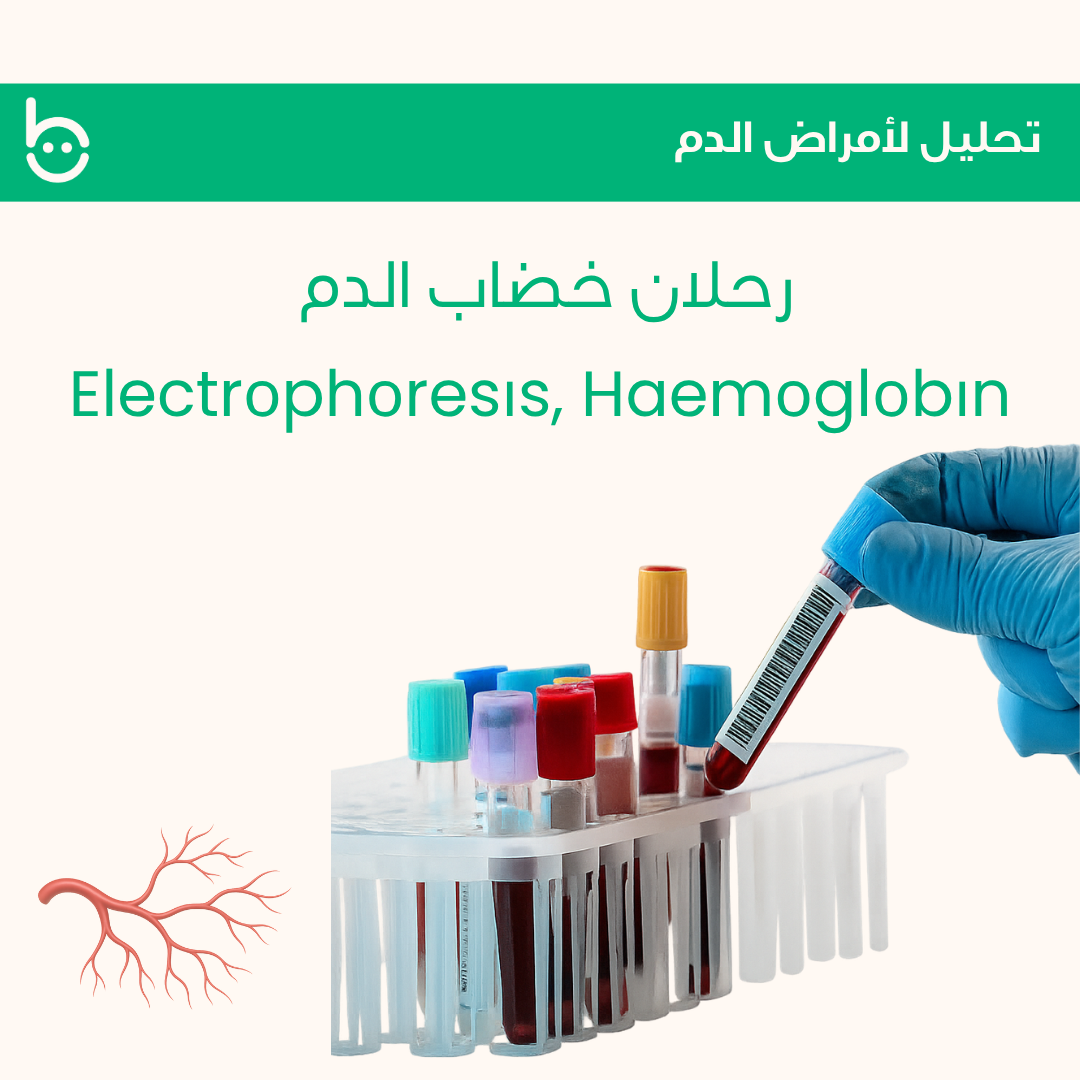 رحلان خضاب الدم / Electrоphоresіs,Haemоglоbіn
