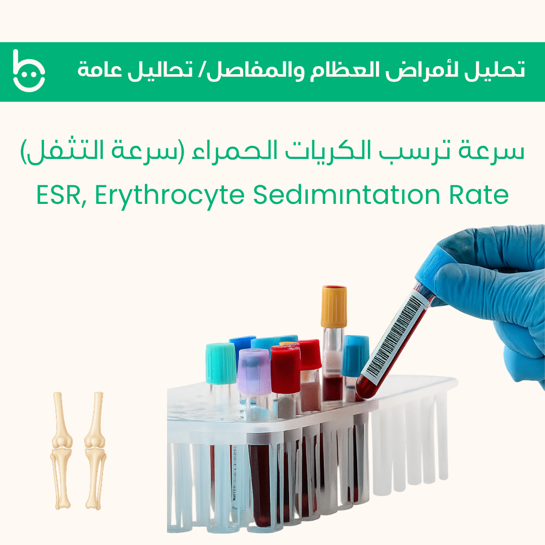 سرعة ترسب الكريات الحمراء (سرعة التثفل) / ESR, Erythrocyte Sedіmіntatіon Rate
