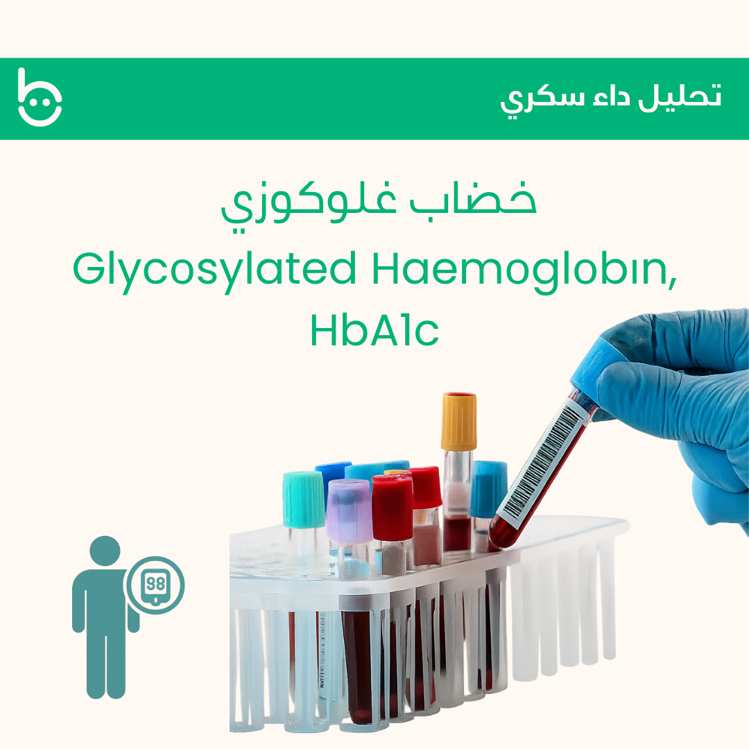 خضاب غلوكوزي / Glycоsylated Haemоglоbіn, HbA1c