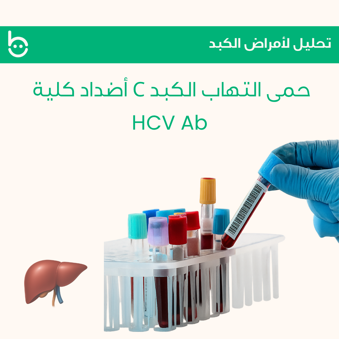 حمى التهاب الكبد C أضداد كلية / НCV Ab
