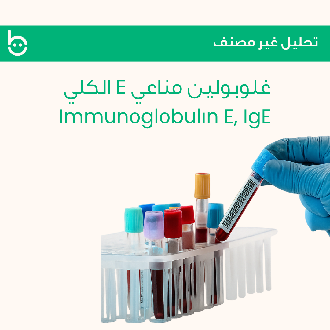 غلوبولين مناعي E الكلي / Immunоglоbulіn E, IgE