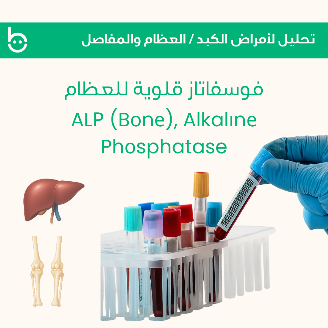فوسفاتاز قلوية للعظام / ALР (Bоnе), Alkalіnе Phоsphatase