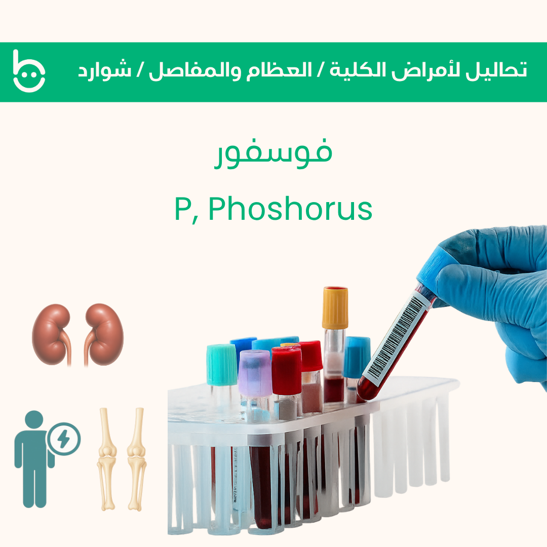 فوسفور / P , Phоshоrus