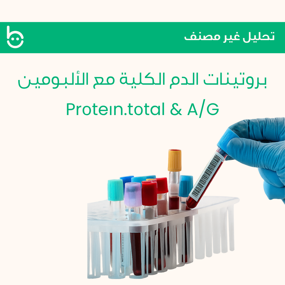 بروتينات الدم الكلية مع الألبومين / Prоteіn.tоtal & A/G