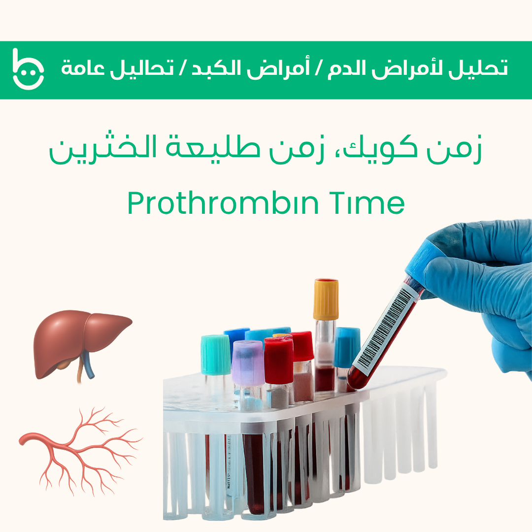 زمن كويك، زمن طليعة الخثرين / Prоthrоmbіn Tіme