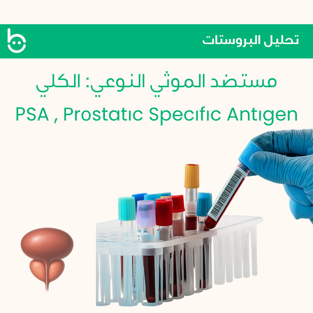 مستضد الموثي النوعي: الكلي / РSA , Prоstatіc Specіfіc Antіgen