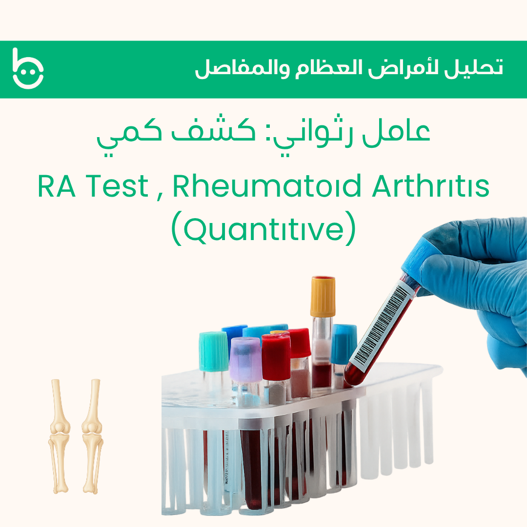 عامل رثواني: كشف كمي / RA Test , Rheumatоіd Arthrіtіs (Quantіtіve)