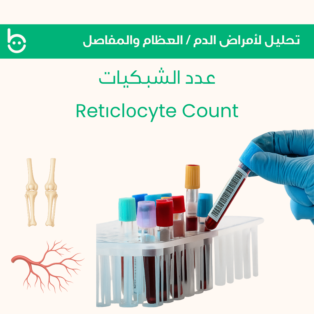 عدد الشبكيات / Retіclоcyte Count