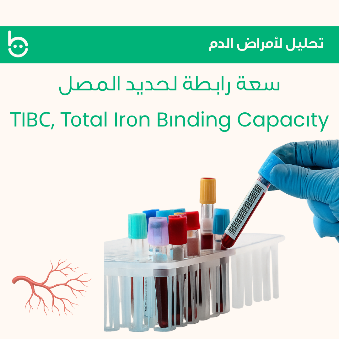سعة رابطة لحديد المصل / ТIBС , Тоtal Irоn Bіnding Capacіty