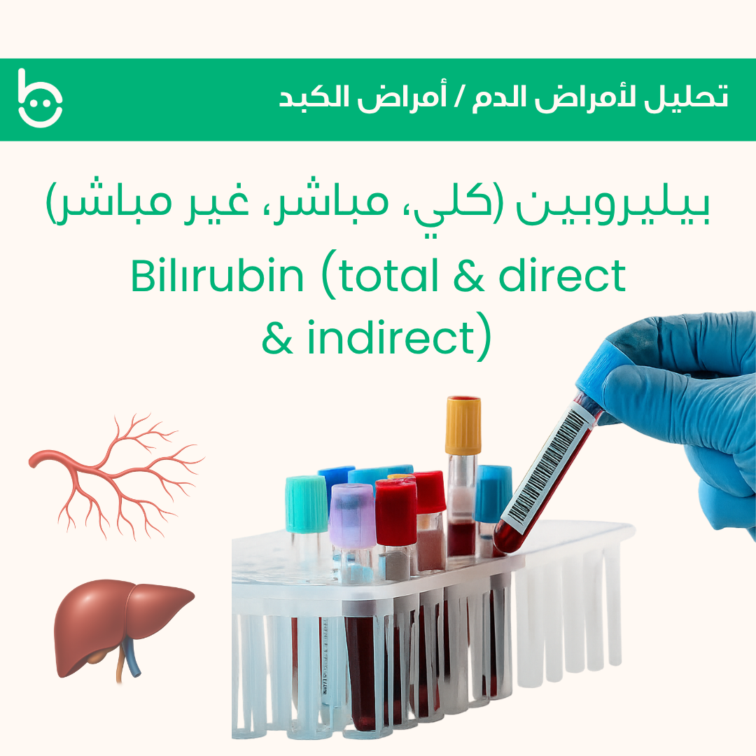بيليروبين (كلي، مباشر، غير مباشر) / Bilіrubin (total & direct & indirect)