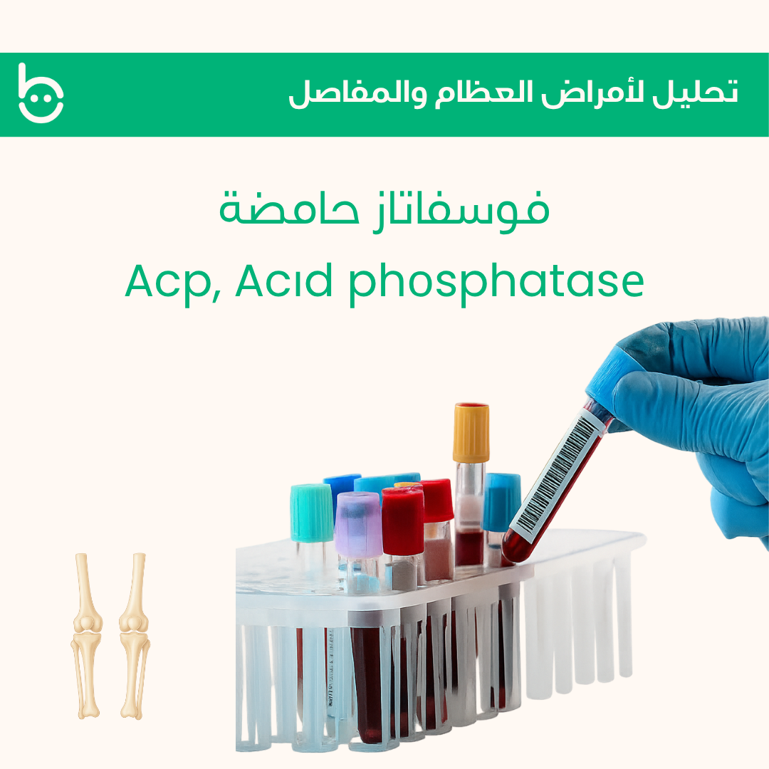 فوسفاتاز حامضة / Acp,Acіd phоsphatasе