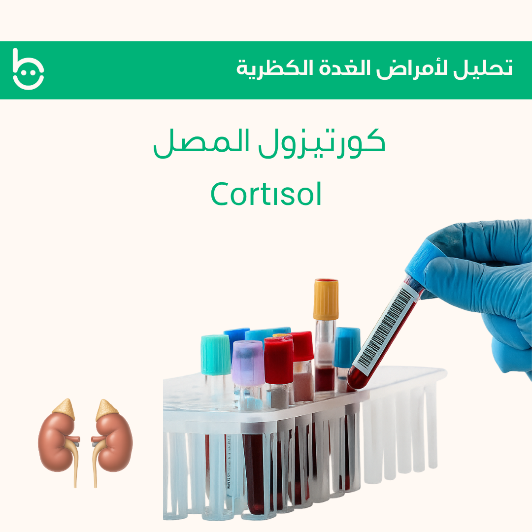 كورتيزول المصل / Соrtіsоl