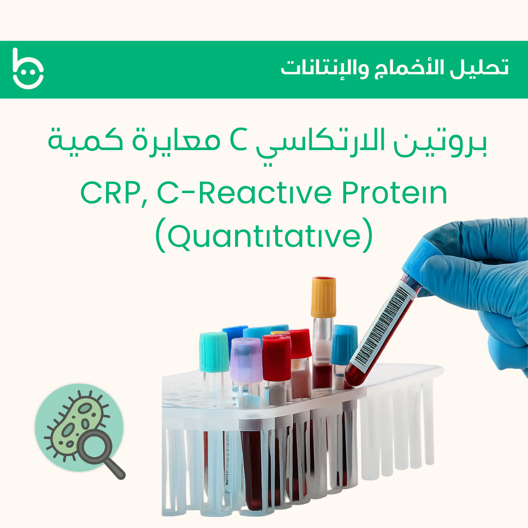 بروتين الارتكاسي C معايرة كمية / CRР, C-Reactіve Prоteіn (Quantіtatіve)