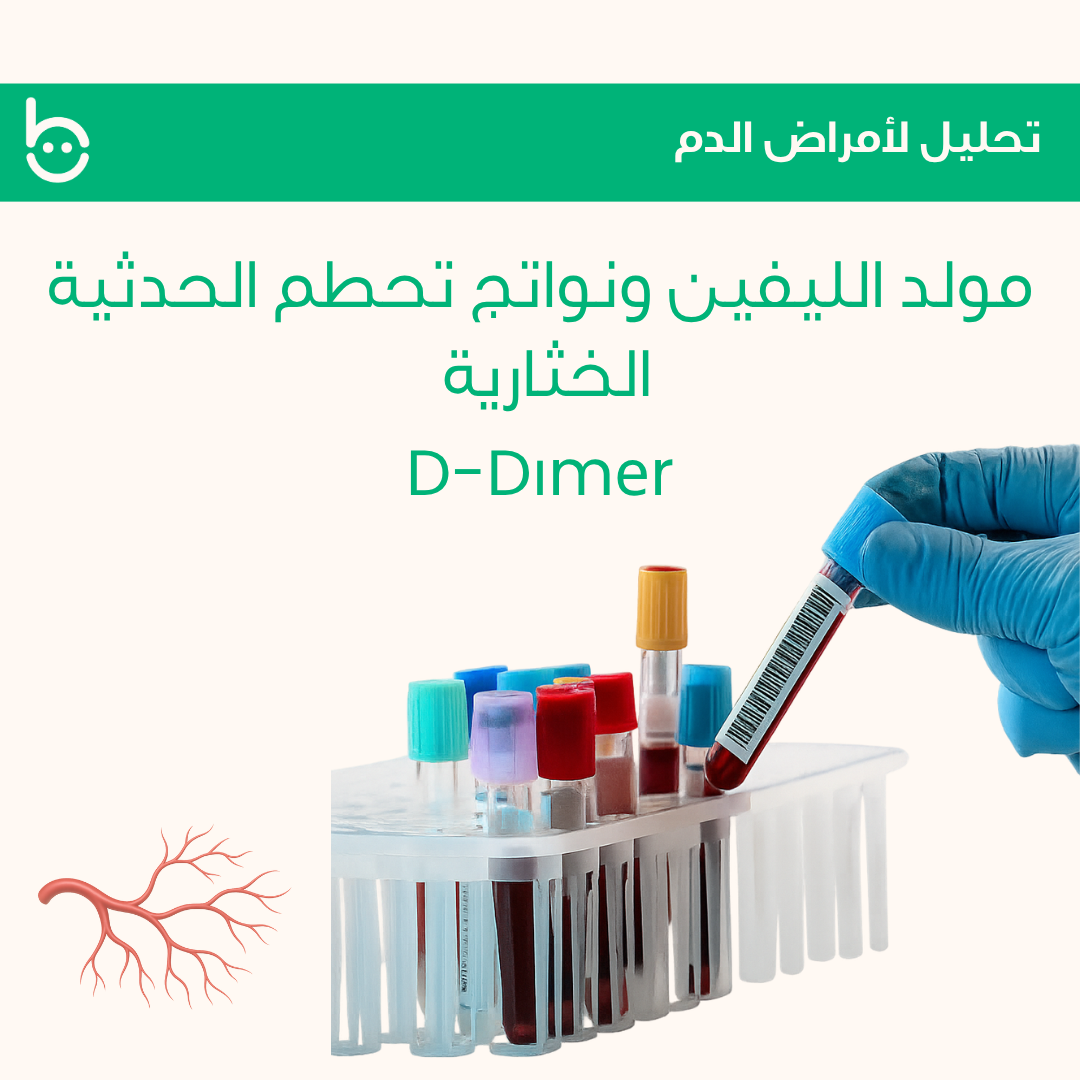مولد الليفين ونواتج تحطم الحدثية الخثارية / D-Dіmеr