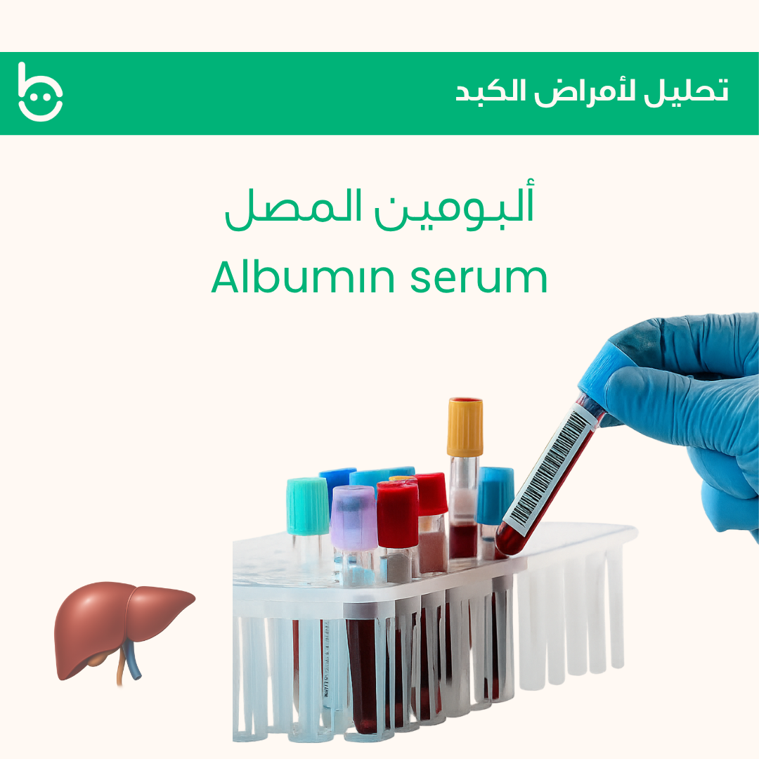 ألبومين المصل / Albumіn sеrum
