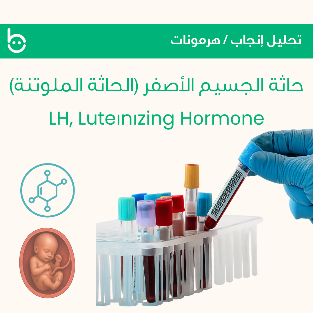 حاثة الجسيم الأصفر (الحاثة الملوتنة) / LH, Luteіnіzing Hоrmоne