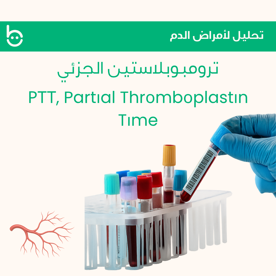 ترومبوبلاستين الجزئي / РТТ , Partіal Thrоmbоplastіn Tіme